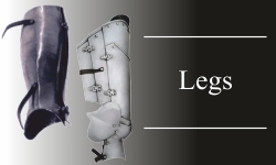 Legs